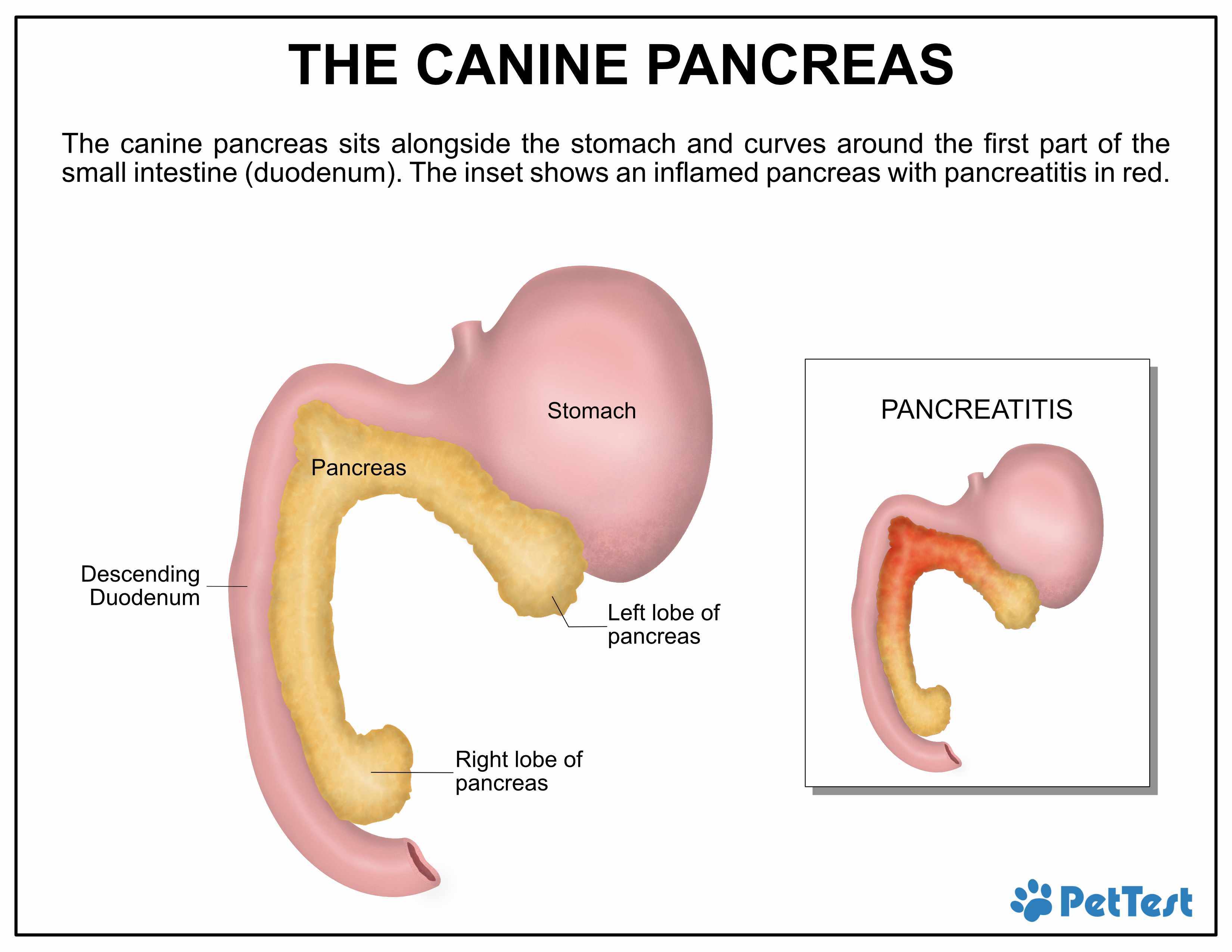 Pancreas, Stomach and Pancreatitis for Blog mtm