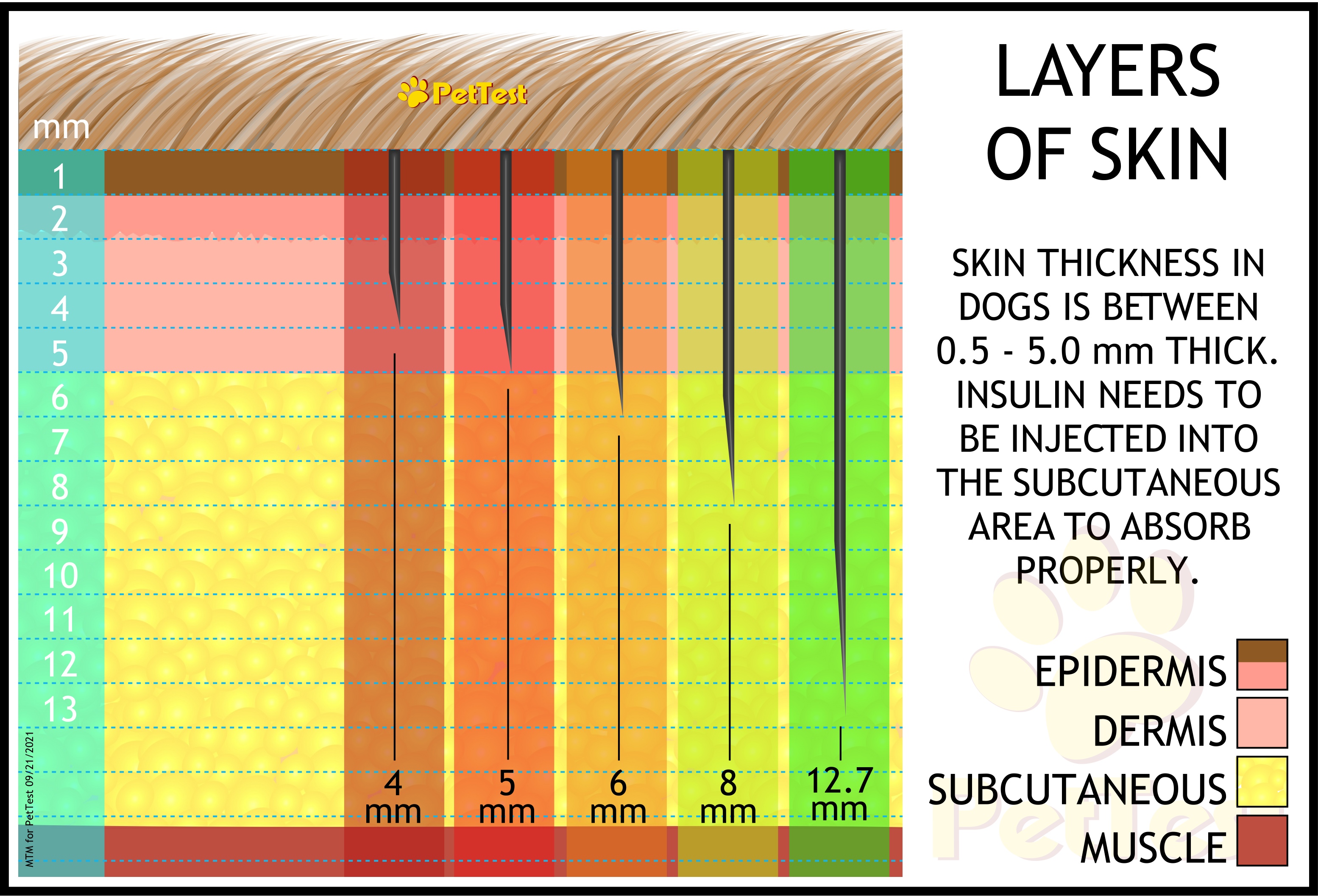 Layers of Skin and Needle Length for PT mtm